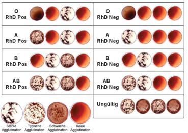3er Blutgruppe Schnelltest - 3x AB0 + Rhesusfaktor