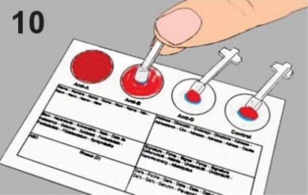 Blutgruppe Schnelltest - Single 1er Set- AB0 + Rhesusfaktor